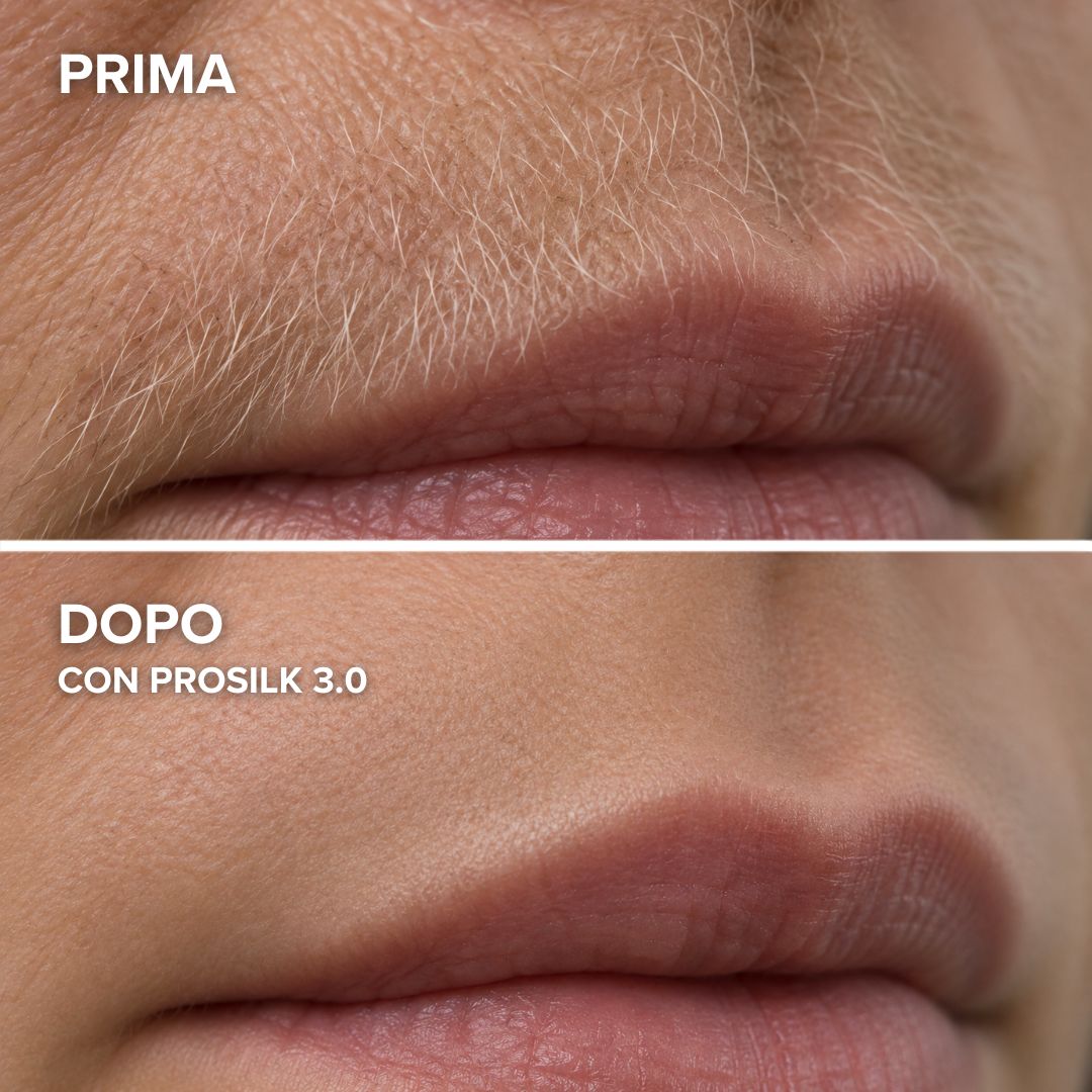 ProSilk 3.0 | Epilatore Viso