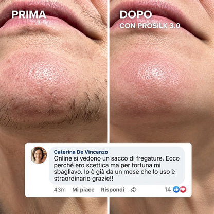 ProSilk 3.0 | Epilatore Viso