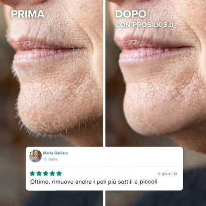 ProSilk 3.0 | Epilatore Viso