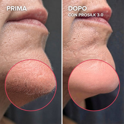 ProSilk 3.0 | Epilatore Viso